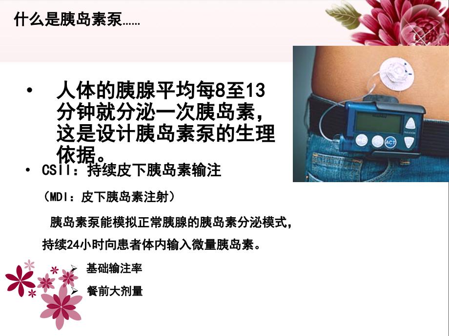 胰岛素泵的规范使用王颖.ppt_第3页