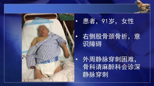 腋静脉穿刺置管课件.pptx