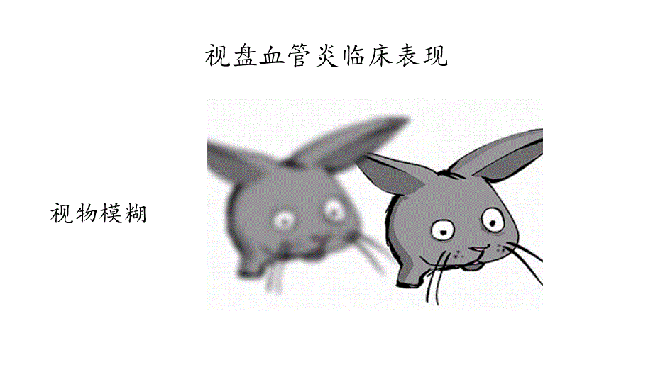 视盘血管炎ppt课件.pptx_第3页