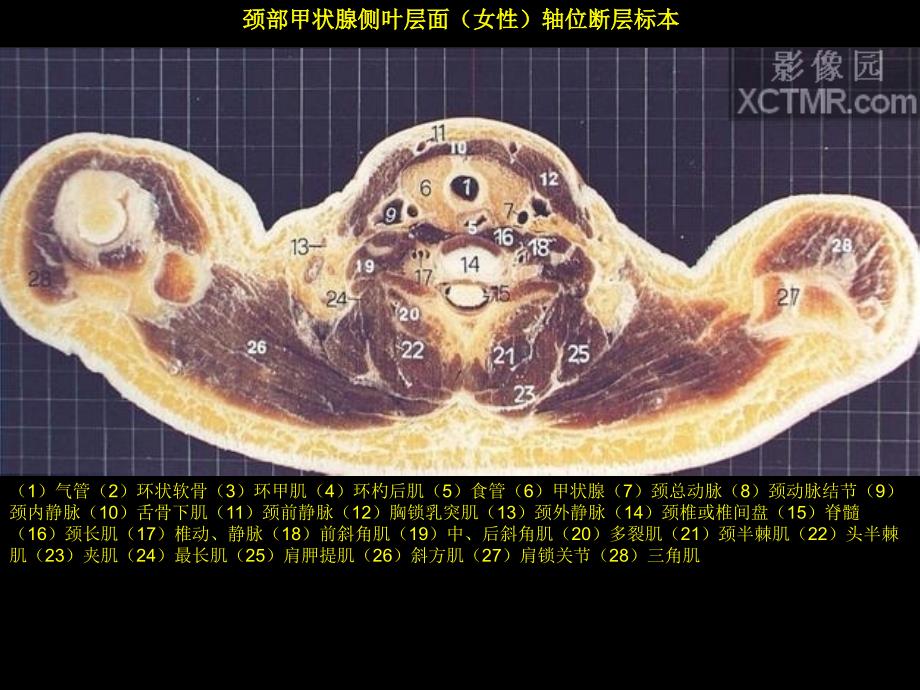 胸部断层解剖.ppt_第2页