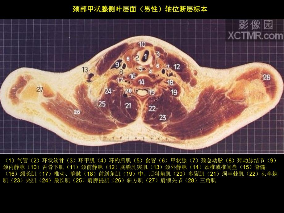 胸部断层解剖.ppt_第3页