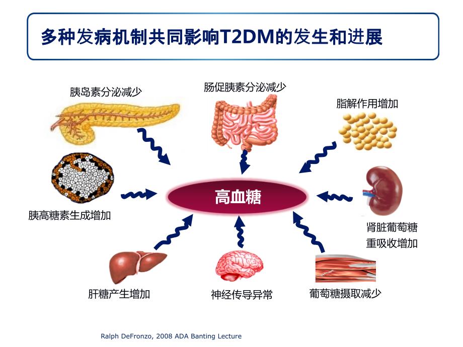 糖尿病药物诊疗新进展.ppt_第3页