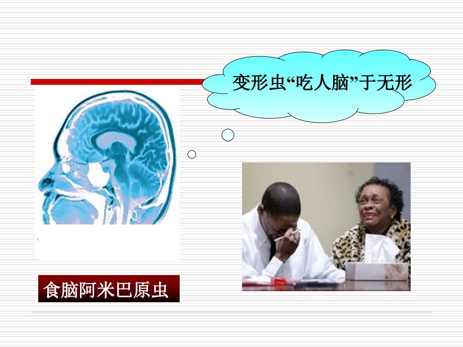 阿米巴痢疾食物中毒精品医学课件.ppt_第2页
