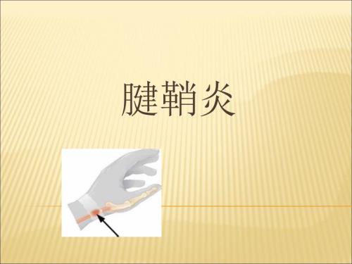 腱鞘炎课件.ppt