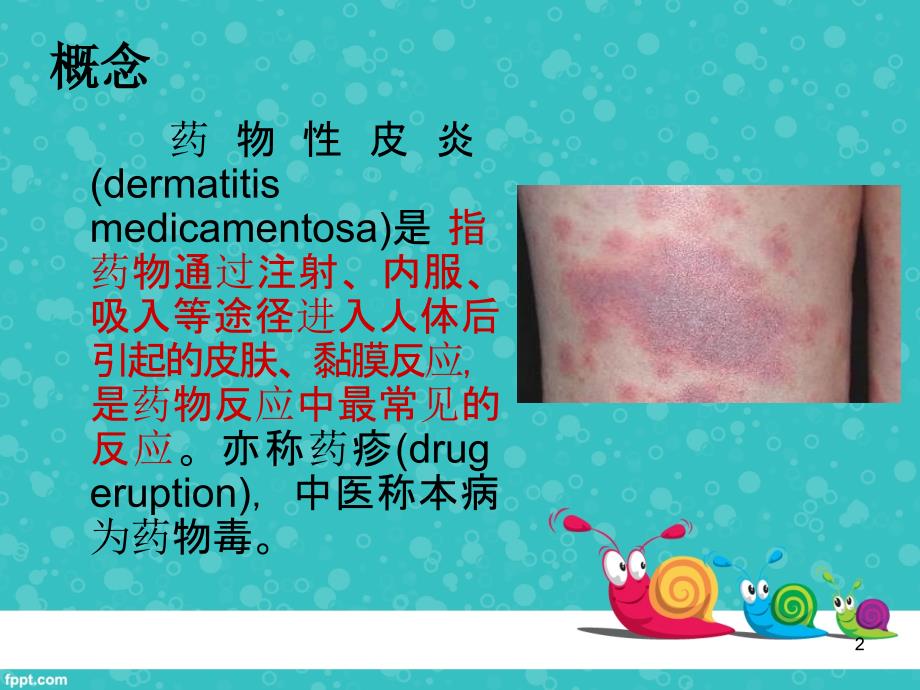 药疹护理查房ppt课件.ppt_第2页