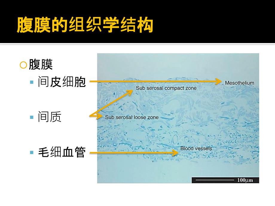 腹膜转运功能与临床应用.ppt_第3页