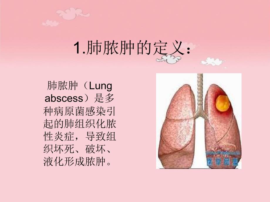 肺脓肿病人的护理查房.ppt_第2页