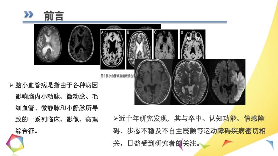 脑小血管病ppt课件.pptx_第2页