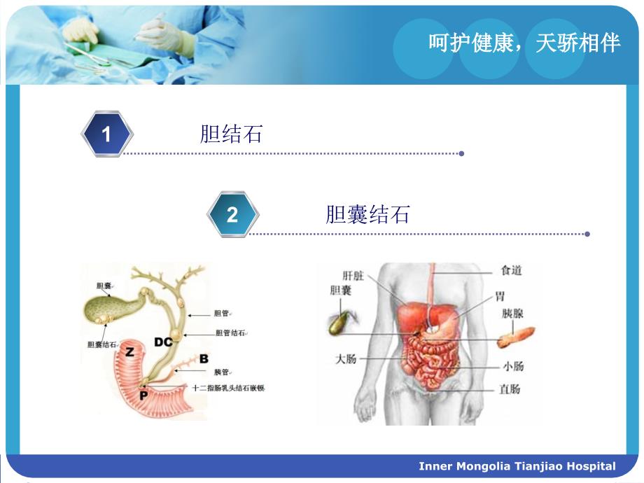 胆结石与胆囊结石PPT课件.ppt_第2页