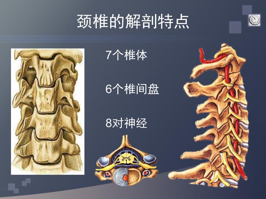 颈椎病的CT诊断课件.ppt_第3页
