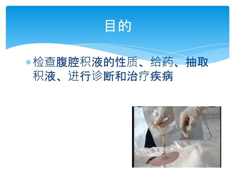 腹腔穿刺术ppt课件.pptx_第2页