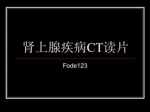 肾上腺疾病CT读片.ppt