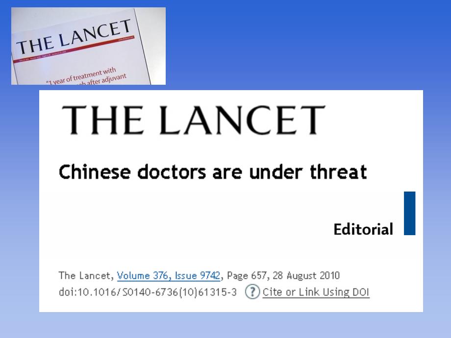 如何预防脊柱手术后静脉血栓.ppt_第1页