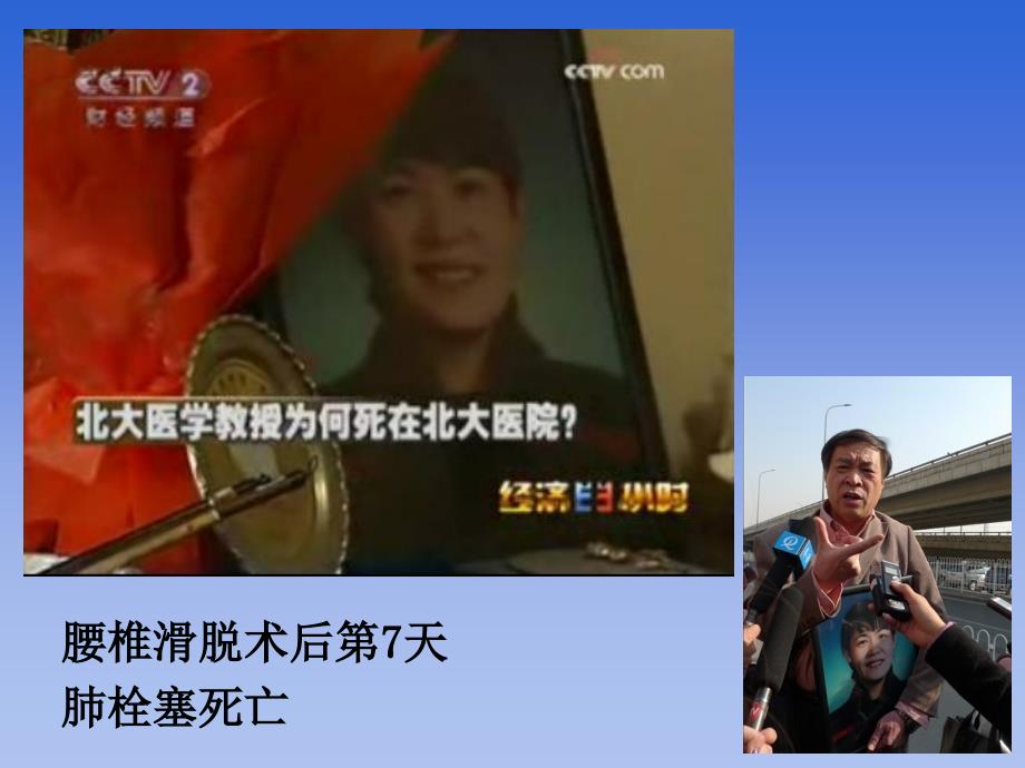 如何预防脊柱手术后静脉血栓.ppt_第2页