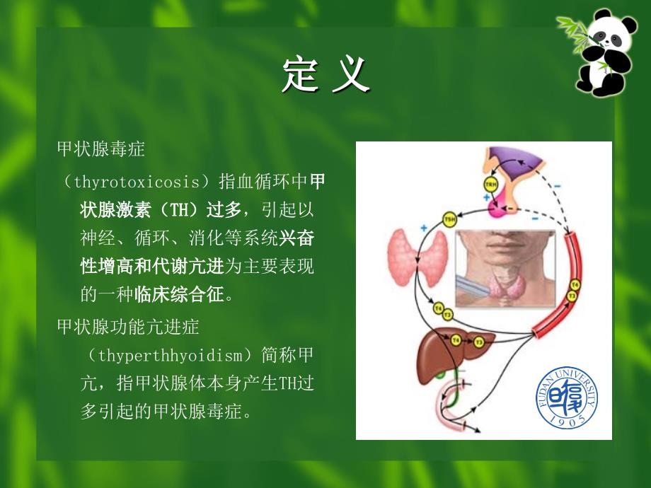 甲亢课件.ppt_第2页
