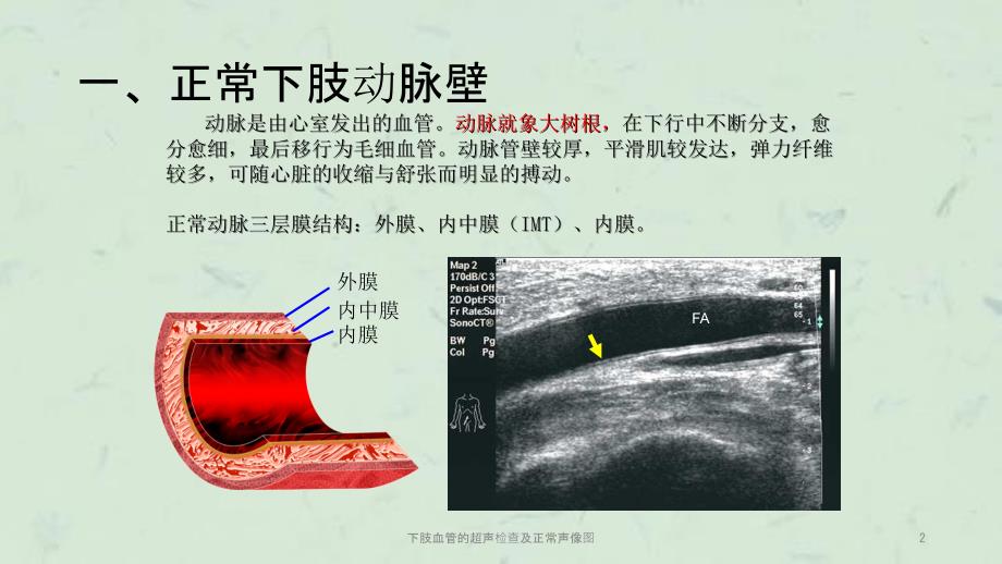 下肢血管的超声检查及正常声像图课件.ppt_第2页