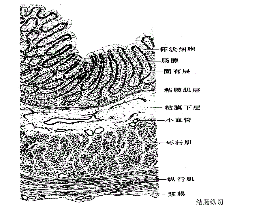 炎症性肠病讲课PPT课件.ppt_第3页