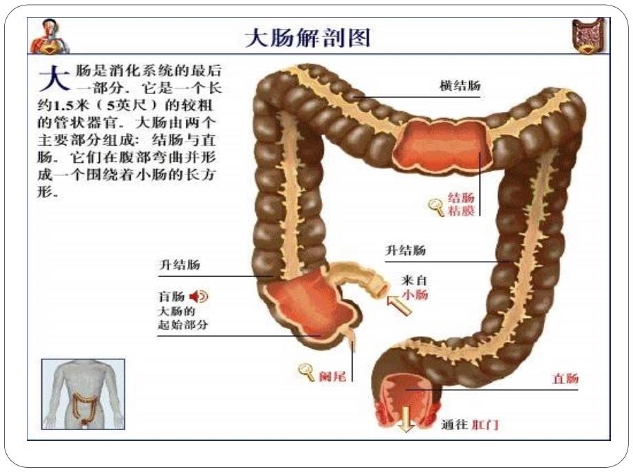 直肠癌术后的护理.PPT_第3页