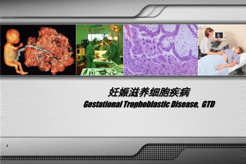妊娠滋养细胞疾病.ppt