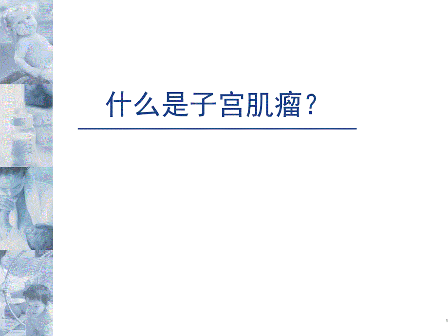 子宫肌瘤科普知识.ppt_第2页