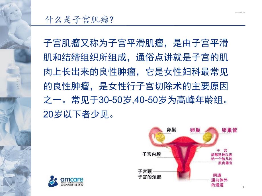 子宫肌瘤科普知识.ppt_第3页