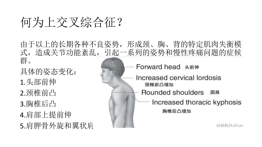 上交叉综合征的肌肉失衡及处理课件.pptx_第2页