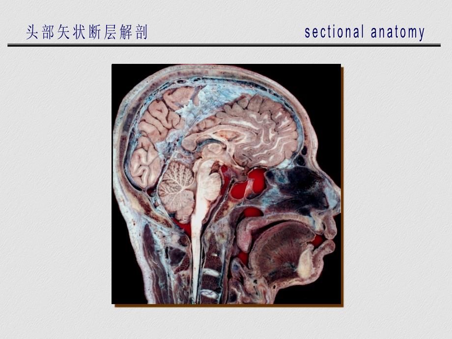头部矢状断层解剖.ppt_第3页