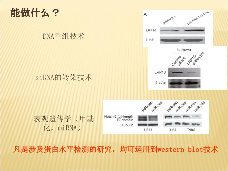 Westernblot的由来原理步骤帮你理解.ppt_第3页