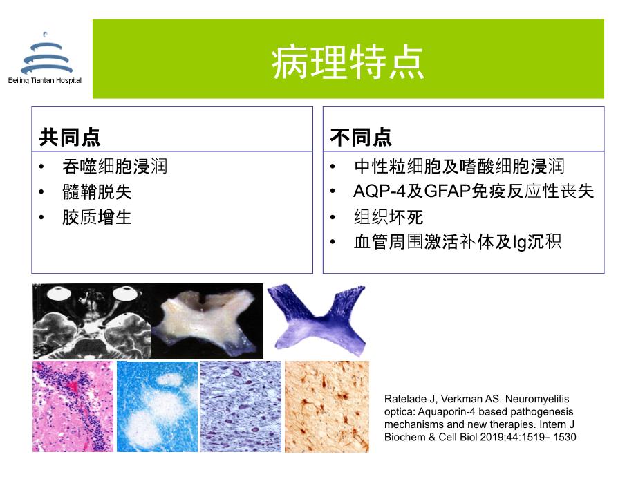 NMO的免疫治疗进展共55页.ppt_第3页