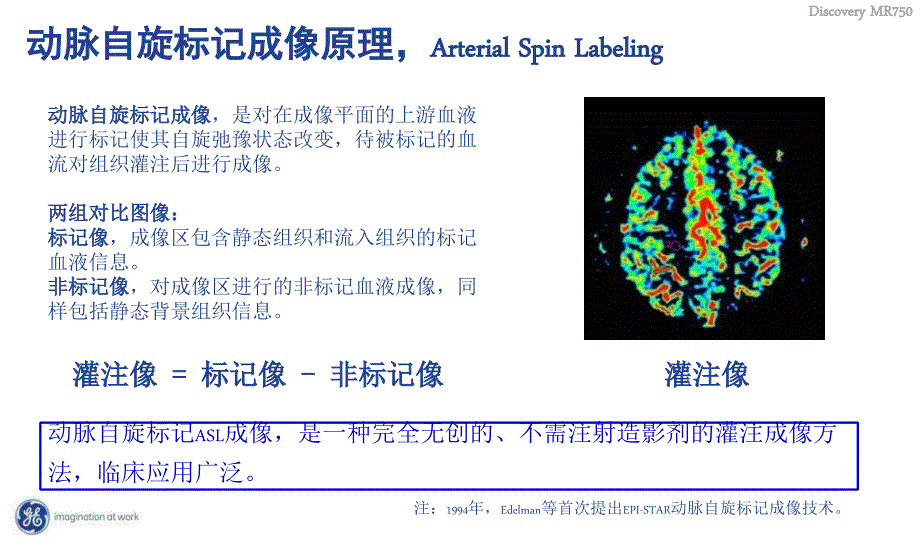 头部ASL灌注成像PPT课件.ppt_第3页