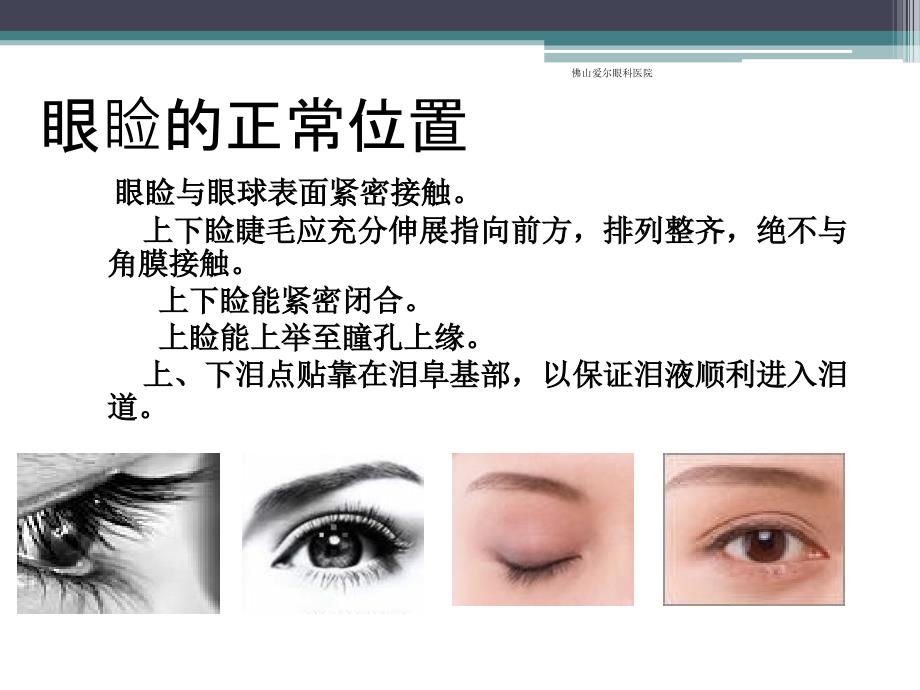 眼睑位置功能和先天异常.ppt_第2页