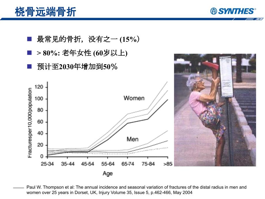 万向锁定加压掌侧双柱接骨板治疗桡骨远端骨折.ppt_第2页
