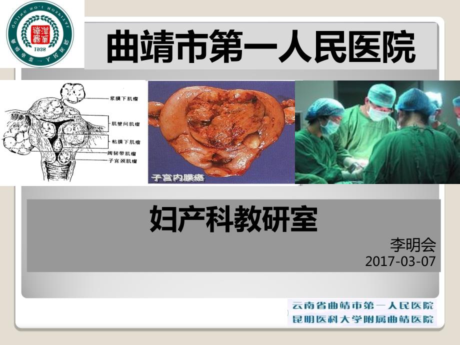 子宫肌瘤教学查房.ppt_第1页
