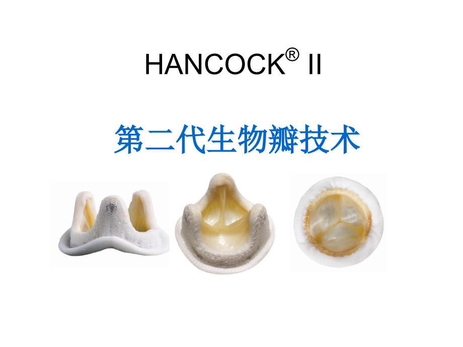 人工生物瓣膜的应用及策略.pptx_第1页