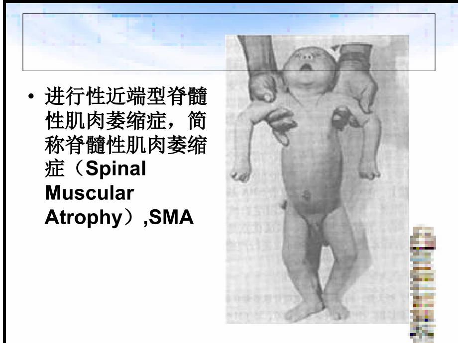 SMA分子检测进展PPT课件.ppt_第2页