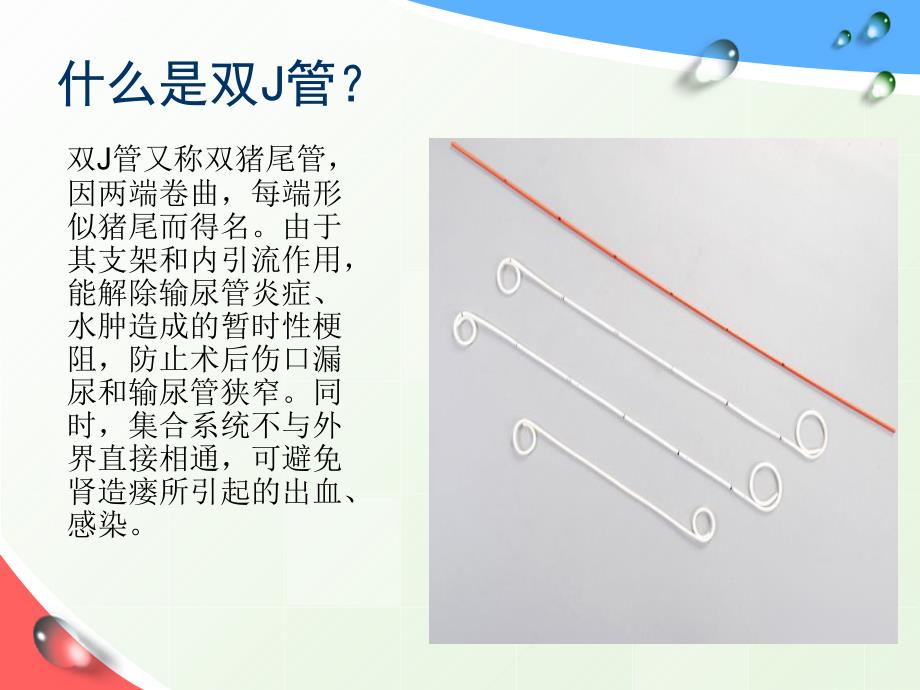 留置双J管的健康指导ppt课件.ppt_第2页