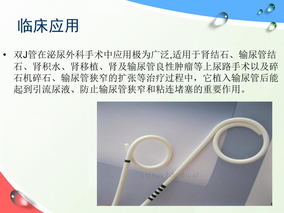 留置双J管的健康指导ppt课件.ppt_第3页