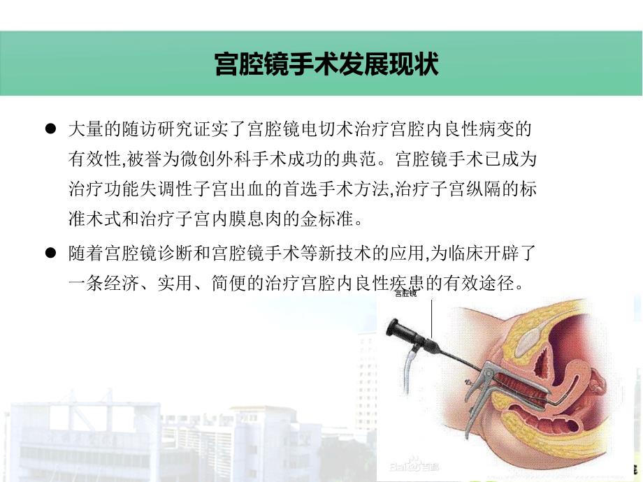 宫腔镜手术的并发症及护理措施.ppt_第3页