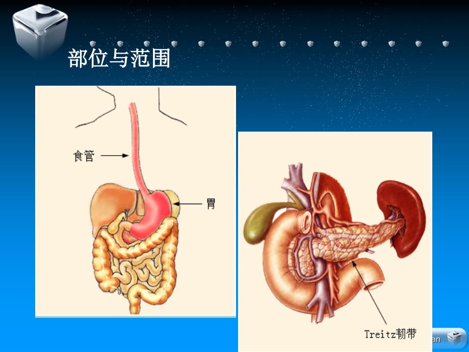 上消化道出血新.ppt_第2页