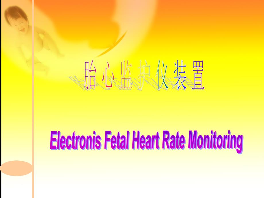 电子胎心监护基本知识PPT课件.ppt_第2页