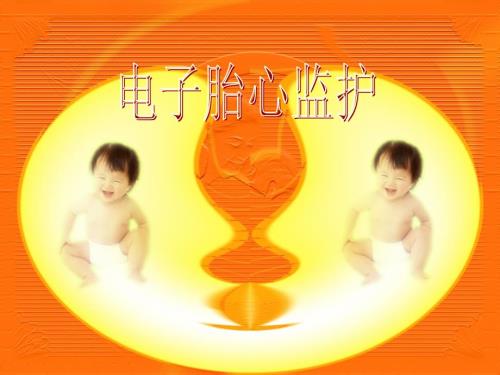 电子胎心监护基本知识PPT课件.ppt