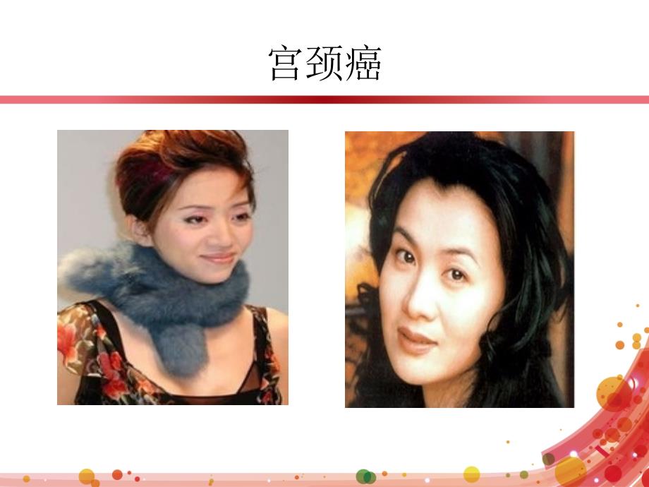 宫颈癌筛查PPT课件.ppt_第2页