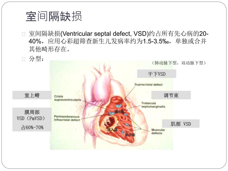 室间隔缺损术后完全性房室传导阻滞.pptx_第2页