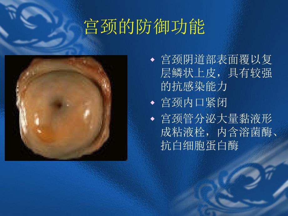 宫颈炎症教学课件幻灯PPT.ppt_第3页