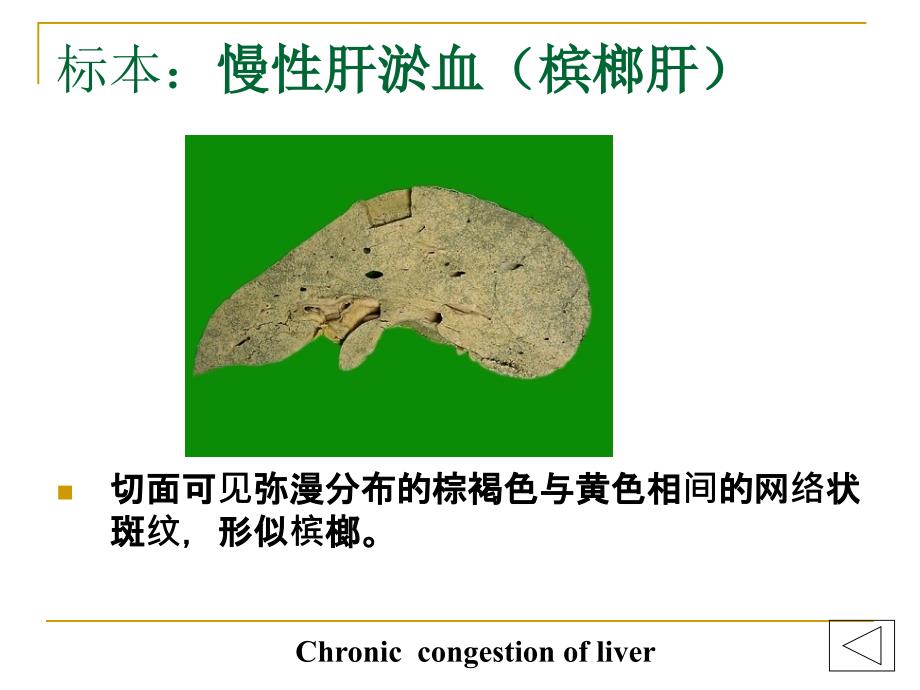 病理学实验大体标本有病理诊断.ppt_第2页