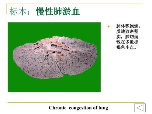 病理学实验大体标本有病理诊断.ppt