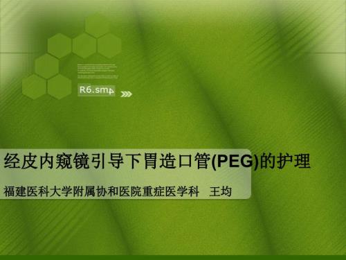 PEG经皮胃造瘘术的护理.ppt