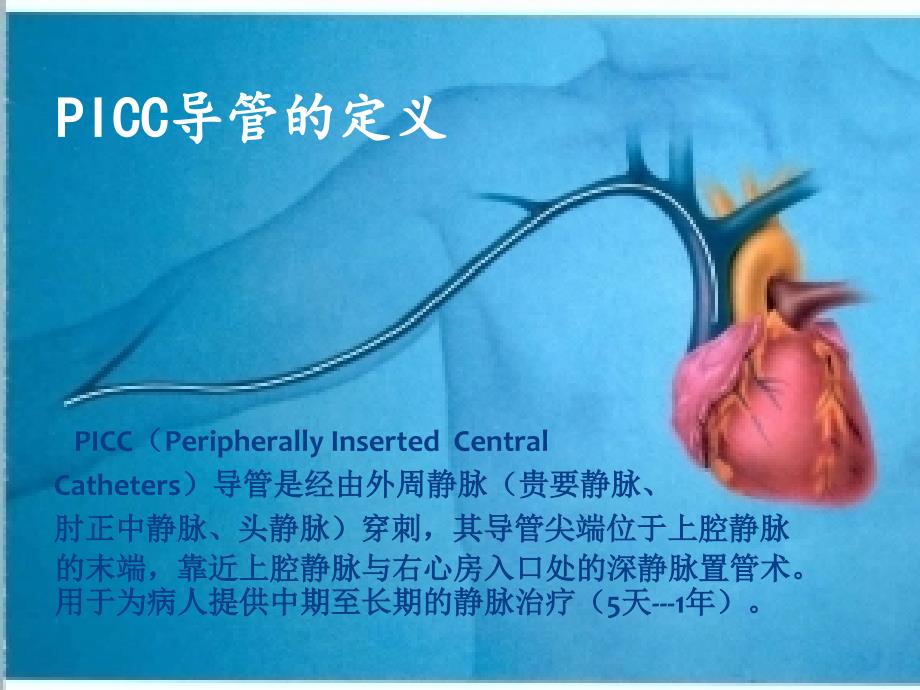PICC置管术课件.ppt_第3页