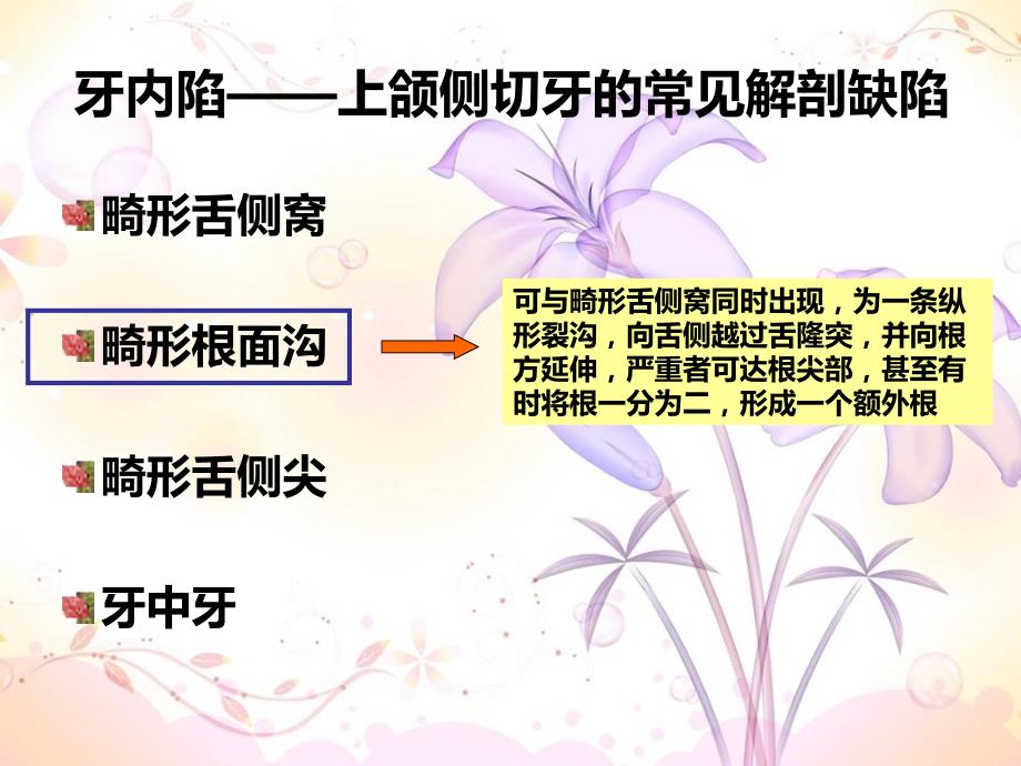 畸形舌侧沟临床对策.ppt_第2页