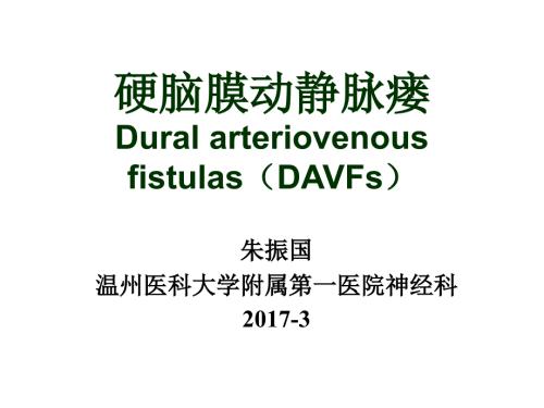 硬脑膜动静脉瘘.ppt